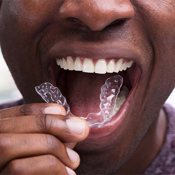 invisalign costs